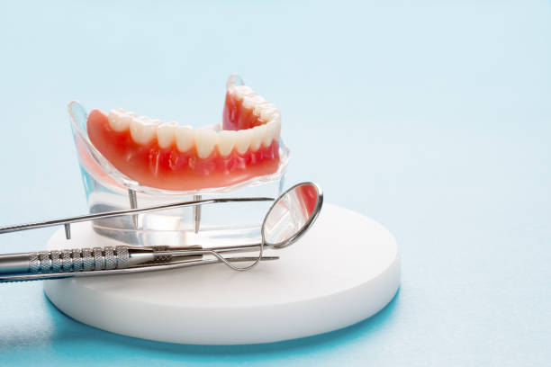 Dental Inlays and Onlays in North Fond Du Lac, WI